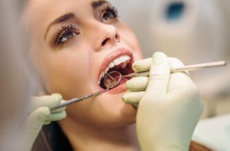 Зубная имплантация – что важно знать